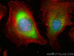 MVP/LRP Antibody in Immunocytochemistry (ICC/IF)