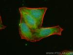 AMZ2 Antibody in Immunocytochemistry (ICC/IF)