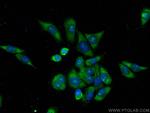 AMZ2 Antibody in Immunocytochemistry (ICC/IF)