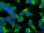 ARPC5 Antibody in Immunocytochemistry (ICC/IF)