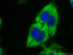 PCK1 Antibody in Immunocytochemistry (ICC/IF)