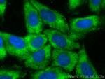 GPT2 Antibody in Immunocytochemistry (ICC/IF)