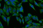 METTL5 Antibody in Immunocytochemistry (ICC/IF)