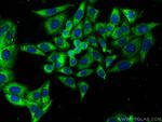 Apolipoprotein A II Antibody in Immunocytochemistry (ICC/IF)