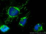 MTCH2 Antibody in Immunocytochemistry (ICC/IF)