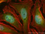 RECQL4 Antibody in Immunocytochemistry (ICC/IF)