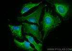 LATS1 Antibody in Immunocytochemistry (ICC/IF)