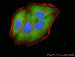LZTFL1 Antibody in Immunocytochemistry (ICC/IF)