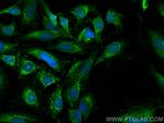 PYCR2 Antibody in Immunocytochemistry (ICC/IF)