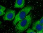 CD5L Antibody in Immunocytochemistry (ICC/IF)