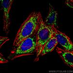 ATPB Antibody in Immunocytochemistry (ICC/IF)