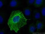 Cytokeratin 16 Antibody in Immunocytochemistry (ICC/IF)