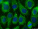 CALML3 Antibody in Immunocytochemistry (ICC/IF)