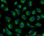 PADI4 Antibody in Immunocytochemistry (ICC/IF)