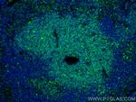 CD3 Antibody in Immunohistochemistry (PFA fixed) (IHC (PFA))