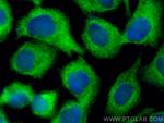 CSK Antibody in Immunocytochemistry (ICC/IF)