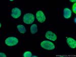 DHX9 Antibody in Immunocytochemistry (ICC/IF)