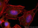 EDC4 Antibody in Immunocytochemistry (ICC/IF)