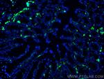 CORO1A Antibody in Immunohistochemistry (PFA fixed) (IHC (PFA))