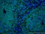 CORO1A Antibody in Immunohistochemistry (PFA fixed) (IHC (PFA))