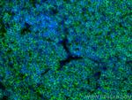 CORO1A Antibody in Immunohistochemistry (PFA fixed) (IHC (PFA))