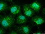 TP53INP1 Antibody in Immunocytochemistry (ICC/IF)