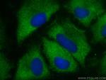 MMP3 Antibody in Immunocytochemistry (ICC/IF)