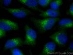 SEC31A Antibody in Immunocytochemistry (ICC/IF)