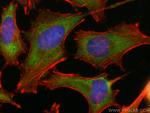 EIF2B1 Antibody in Immunocytochemistry (ICC/IF)
