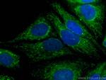 PDH E1 Alpha Antibody in Immunocytochemistry (ICC/IF)