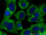 MMP13 Antibody in Immunocytochemistry (ICC/IF)