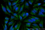 EIF2AK2, PKR Antibody in Immunocytochemistry (ICC/IF)
