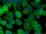 PHLDA1 Antibody in Immunocytochemistry (ICC/IF)