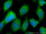 SSH3 Antibody in Immunocytochemistry (ICC/IF)