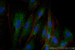 TRIM41 Antibody in Immunocytochemistry (ICC/IF)