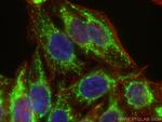 CPS1 Antibody in Immunocytochemistry (ICC/IF)