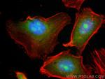 BAG1 Antibody in Immunocytochemistry (ICC/IF)