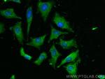 RAP1GAP Antibody in Immunocytochemistry (ICC/IF)