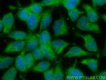 ZIP7 Antibody in Immunocytochemistry (ICC/IF)