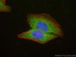 SLK Antibody in Immunocytochemistry (ICC/IF)