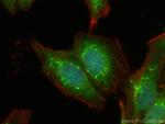 APPL1 Antibody in Immunocytochemistry (ICC/IF)