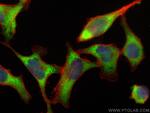 BZW1 Antibody in Immunocytochemistry (ICC/IF)