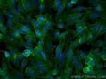 MCT1 Antibody in Immunocytochemistry (ICC/IF)