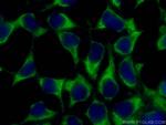 KGA Antibody in Immunocytochemistry (ICC/IF)