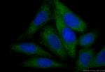 IGF1B Antibody in Immunocytochemistry (ICC/IF)