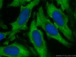 CLEC3B Antibody in Immunocytochemistry (ICC/IF)