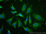 PRDX1 Antibody in Immunocytochemistry (ICC/IF)