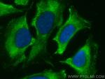 mDia1 Antibody in Immunocytochemistry (ICC/IF)
