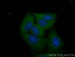 CXCR2 Antibody in Immunocytochemistry (ICC/IF)