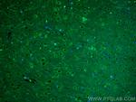PSD95, DLG4 Antibody in Immunohistochemistry (PFA fixed) (IHC (PFA))